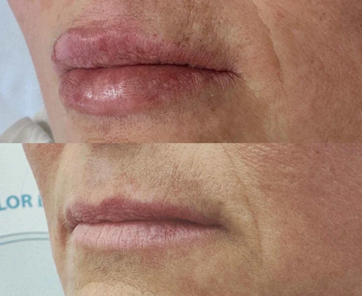Labios antes y después del trabajo de contorno y color