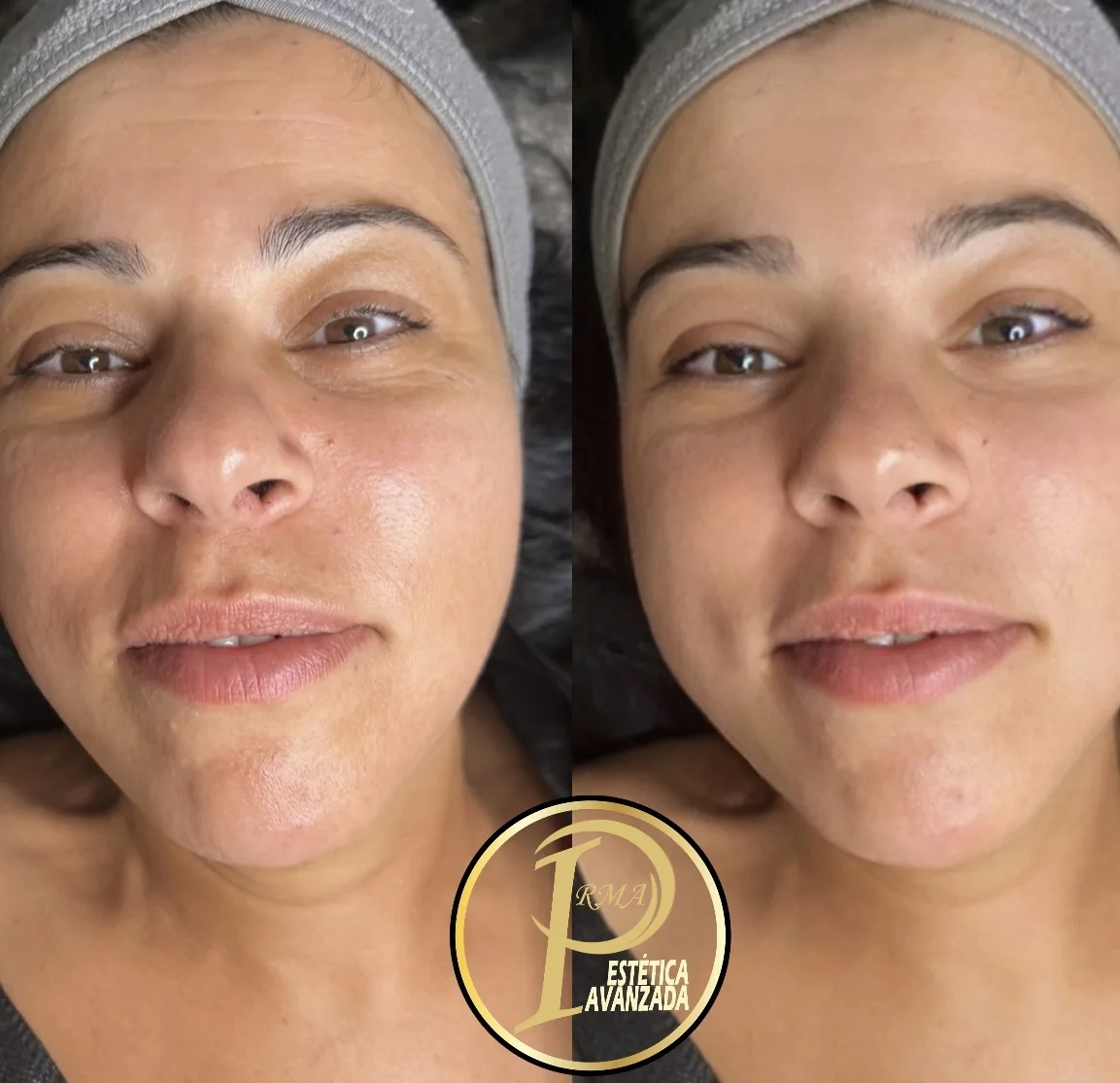 Rostro antes y después, con la piel más luminosa