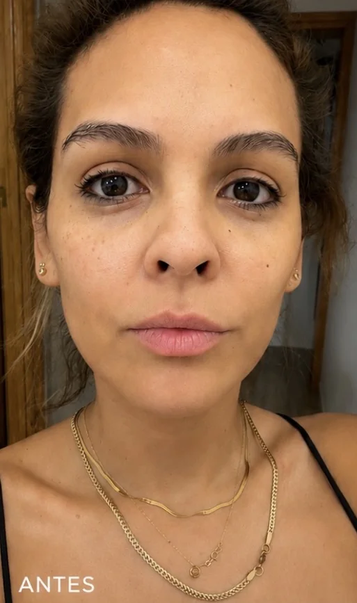 Rostro completo antes del tratamiento