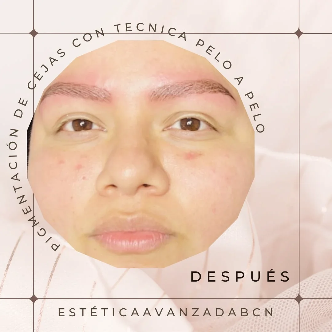 Cejas micropigmentadas, trabajo real de consulta