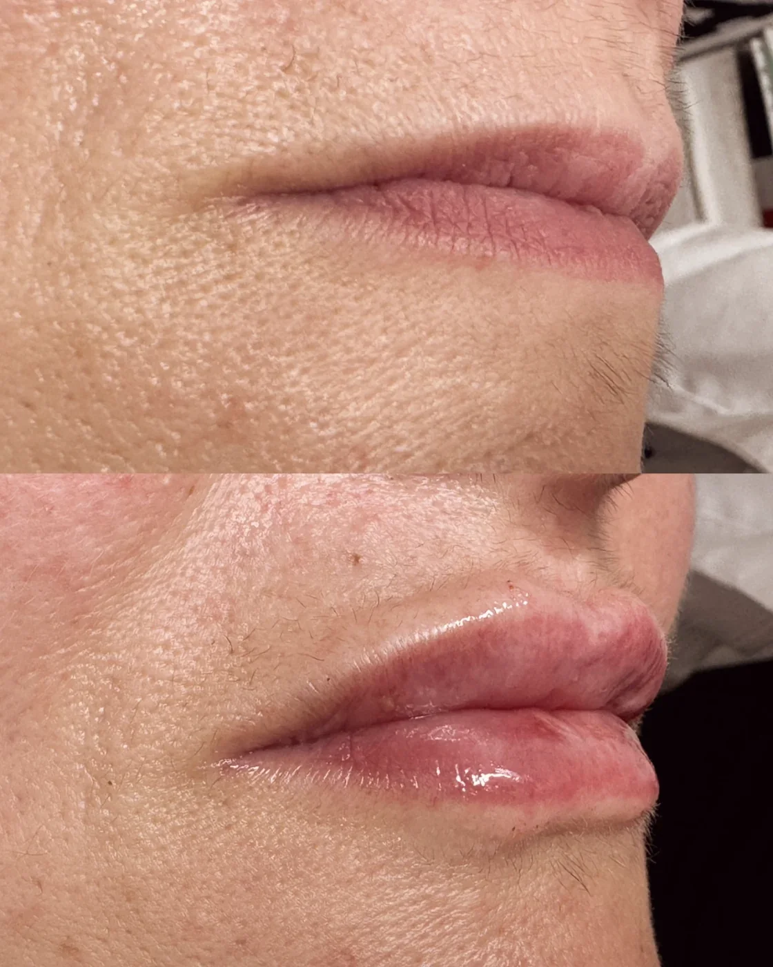 Labios hidratados y definidos tras la sesión