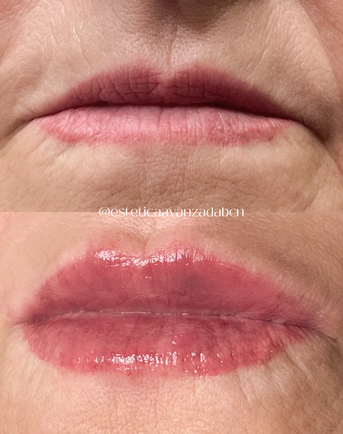 Detalle de labio hidratado tras la sesión