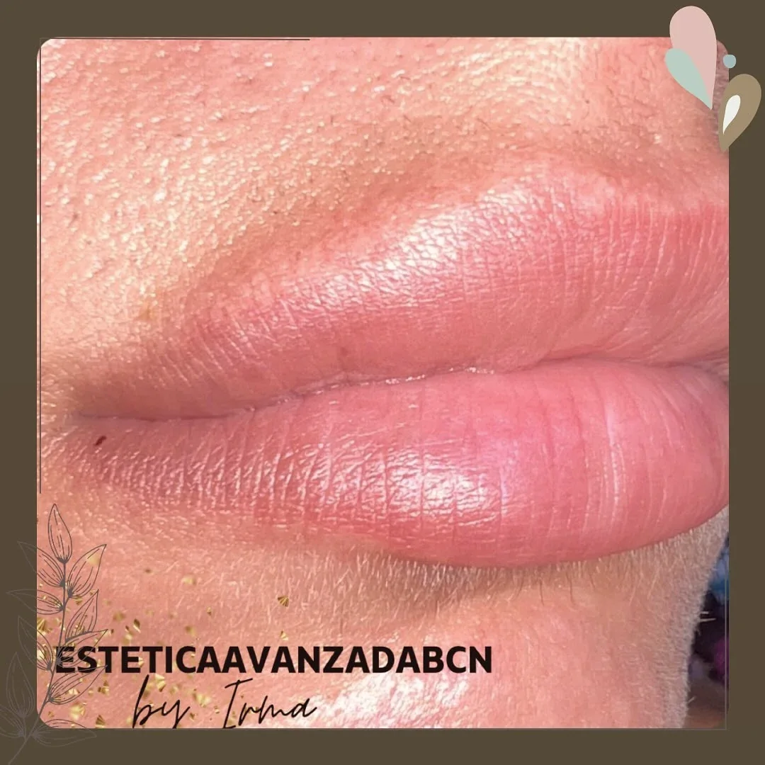 Labios con micropigmentación de color natural