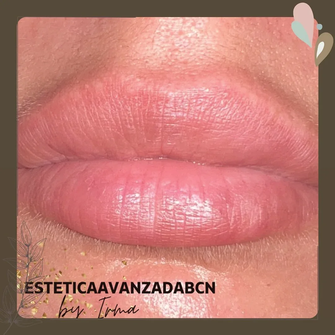 Detalle del contorno y el color tras la micropigmentación de labios