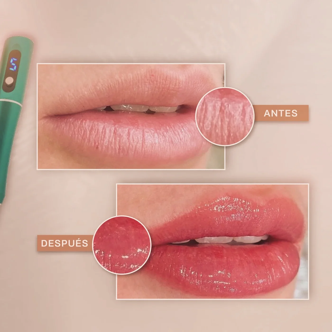 Labios antes y después de la micropigmentación de labios